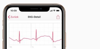 Funcționalitatea EKG și notificările de FiA sunt disponibile pentru utilizatorii de Apple Watch din România ekg apple watch romania